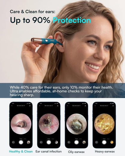 Bebird EarSight Ultra - 2K Smart Visual Ear Cleaner
