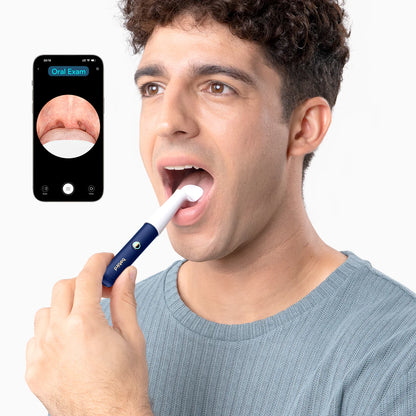 Bebird EarSight Plus Smart Visual Ear Cleaner – Blue / White