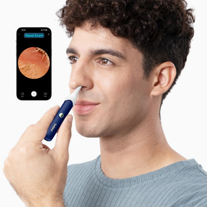 Bebird EarSight Plus Smart Visual Ear Cleaner – Blue / White
