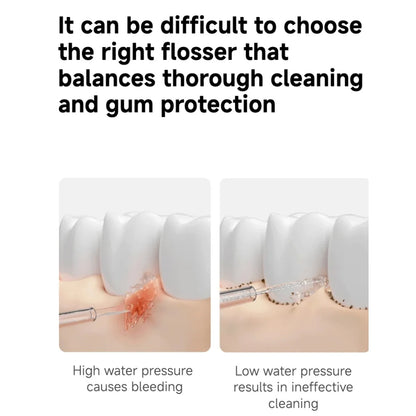 Xiaomi Water Flosser 2